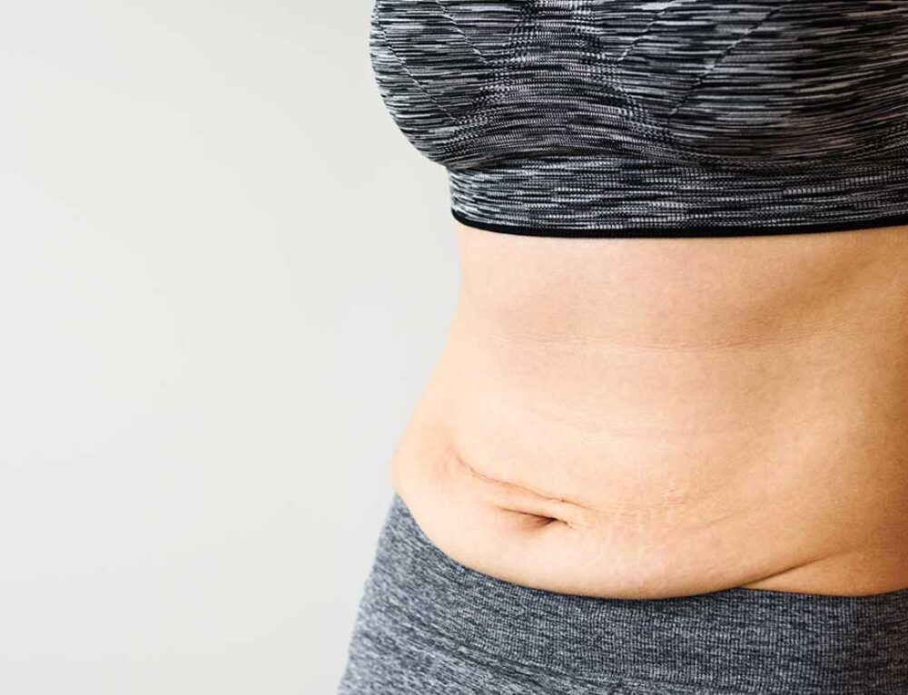 Ozempic Vs Jardiance For Weight Loss Diabetes Bisonpharmacy